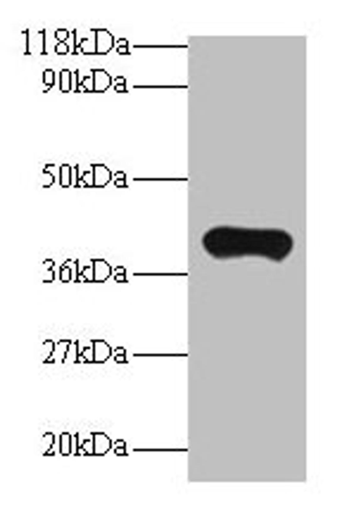 Western blot. All lanes: PON1 antibody at 2µg/ml + Mouse liver tissue. Secondary. Goat polyclonal to rabbit IgG at 1/10000 dilution. Predicted band size: 40 kDa. Observed band size: 40 kDa