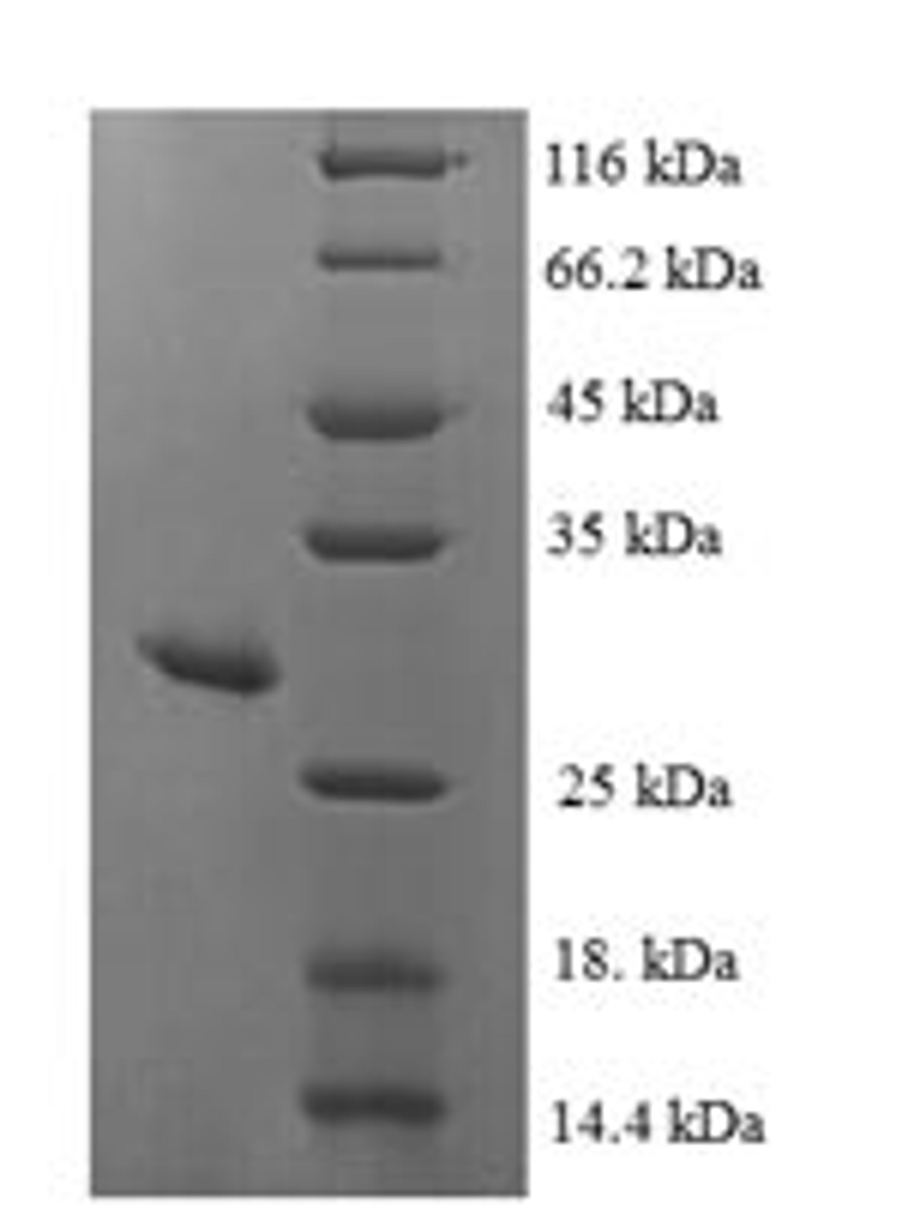 (Tris-Glycine gel) Discontinuous SDS-PAGE (reduced) with 5% enrichment gel and 15% separation gel.