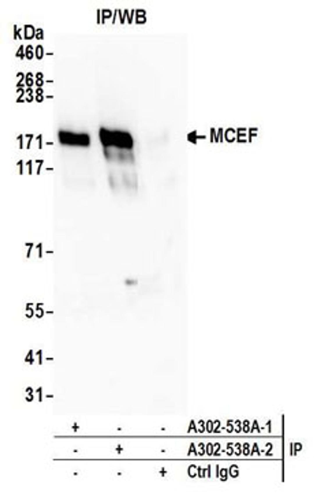 Detection of Human MCEF by Western Blot of Immunoprecipitates.