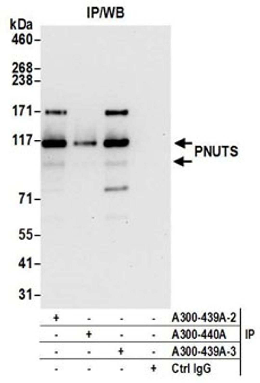 Detection of human PNUTS by western blot of immunoprecipitates.