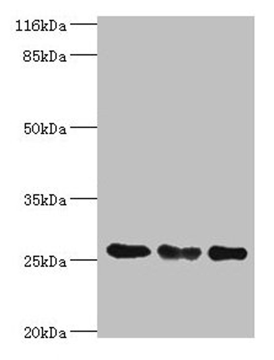 Western blot. All lanes: TFAM antibody at 8µg/ml. Lane 1: Jurkat whole cell lysate. Lane 2: MCF-7 whole cell lysate. Lane 3: A431 whole cell lysate. Secondary. Goat polyclonal to rabbit IgG at 1/10000 dilution. Predicted band size: 30, 26 kDa. Observed band size: 26 kDa