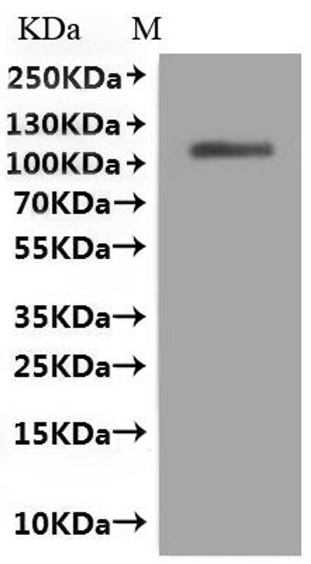 (Tris-Glycine gel) Discontinuous SDS-PAGE (reduced) with 5% enrichment gel and 15% separation gel.
