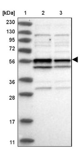 Western Blot: CCDC76 Antibody [NBP1-84643] - Lane 1: Marker [kDa] 230, 130, 95, 72, 56, 36, 28, 17, 11<br/>Lane 2: Human cell line RT-4<br/>Lane 3: Human cell line U-251MG sp