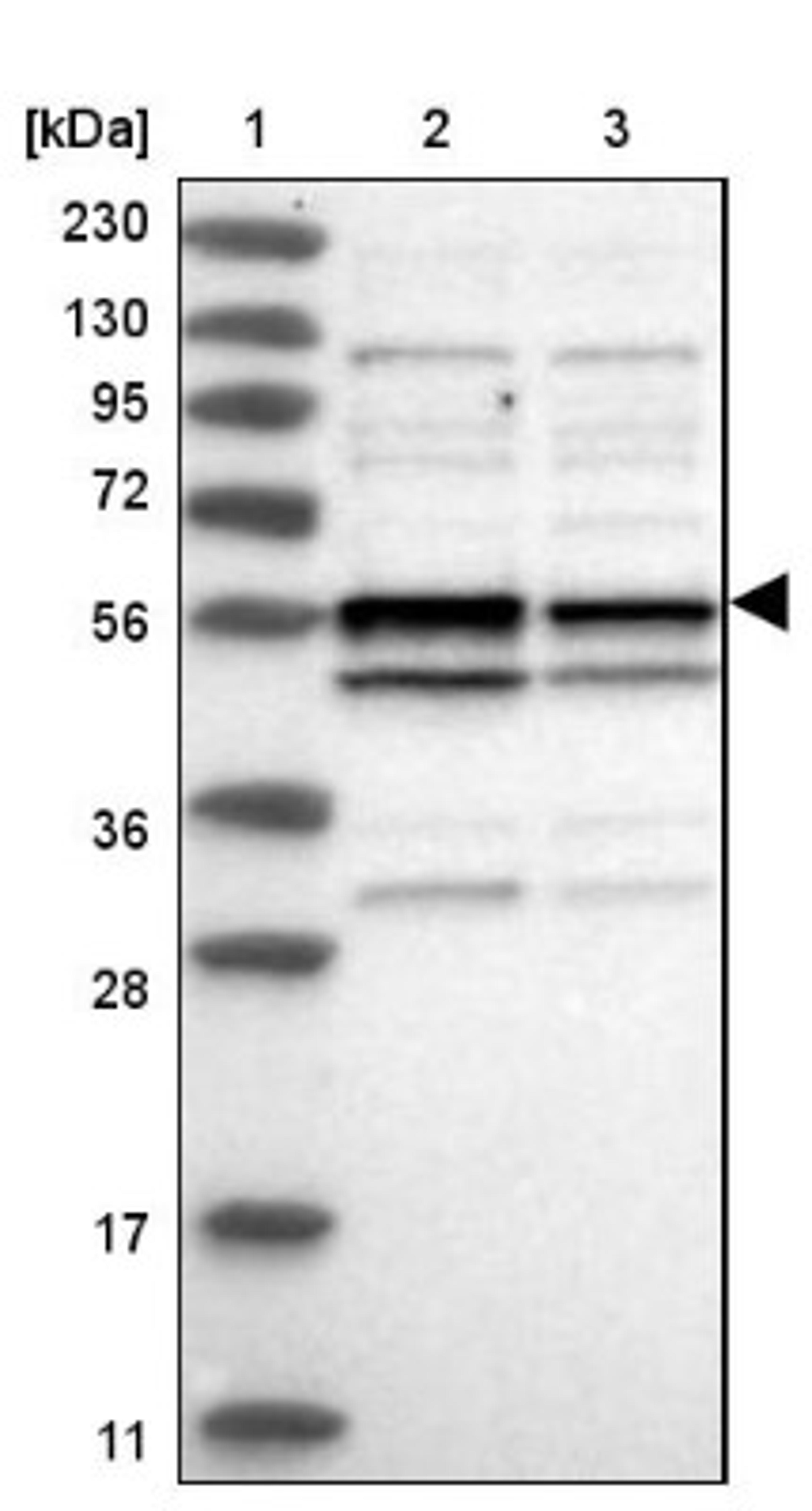 Western Blot: CCDC76 Antibody [NBP1-84643] - Lane 1: Marker [kDa] 230, 130, 95, 72, 56, 36, 28, 17, 11<br/>Lane 2: Human cell line RT-4<br/>Lane 3: Human cell line U-251MG sp