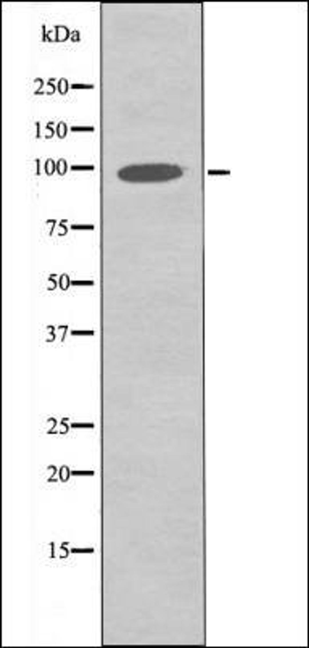 Western blot analysis of HuvEc whole cell lysates using FGFR3 -Phospho-Tyr760- antibody