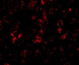 Immunocytochemistry/Immunofluorescence: AFAP1L2 Antibody [NBP1-77358] - Immunofluorescence of AFAP1L2 in human liver tissue with AFAP1L antibody at 20 ug/mL.