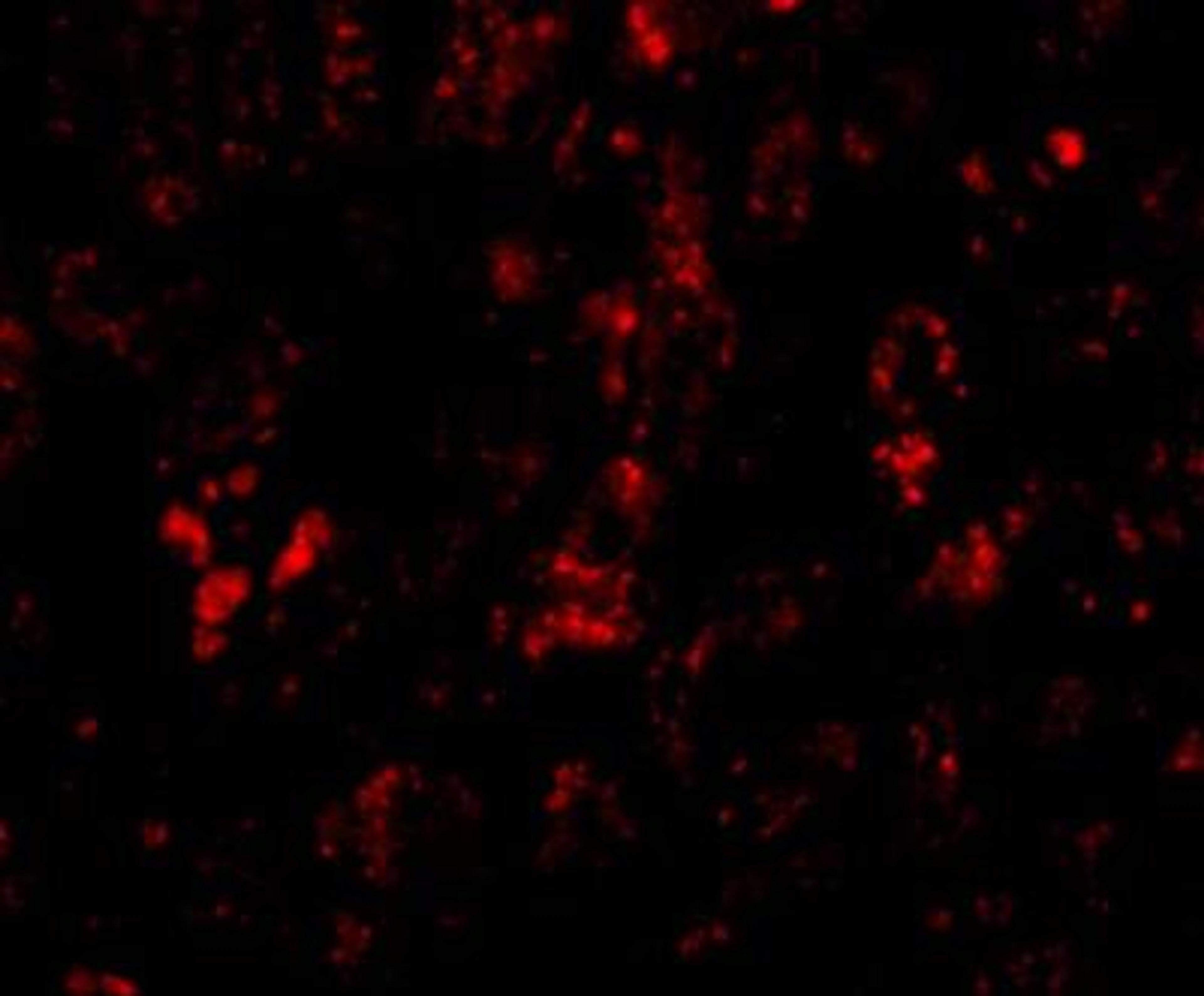 Immunocytochemistry/Immunofluorescence: AFAP1L2 Antibody [NBP1-77358] - Immunofluorescence of AFAP1L2 in human liver tissue with AFAP1L antibody at 20 ug/mL.