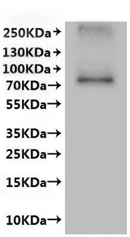 CSB-MP861992HU is detected by Mouse anti-6*His monoclonal antibody.