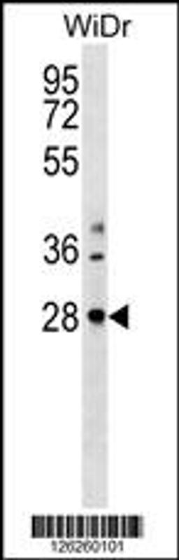 Western blot analysis in WiDr cell line lysates (35ug/lane).