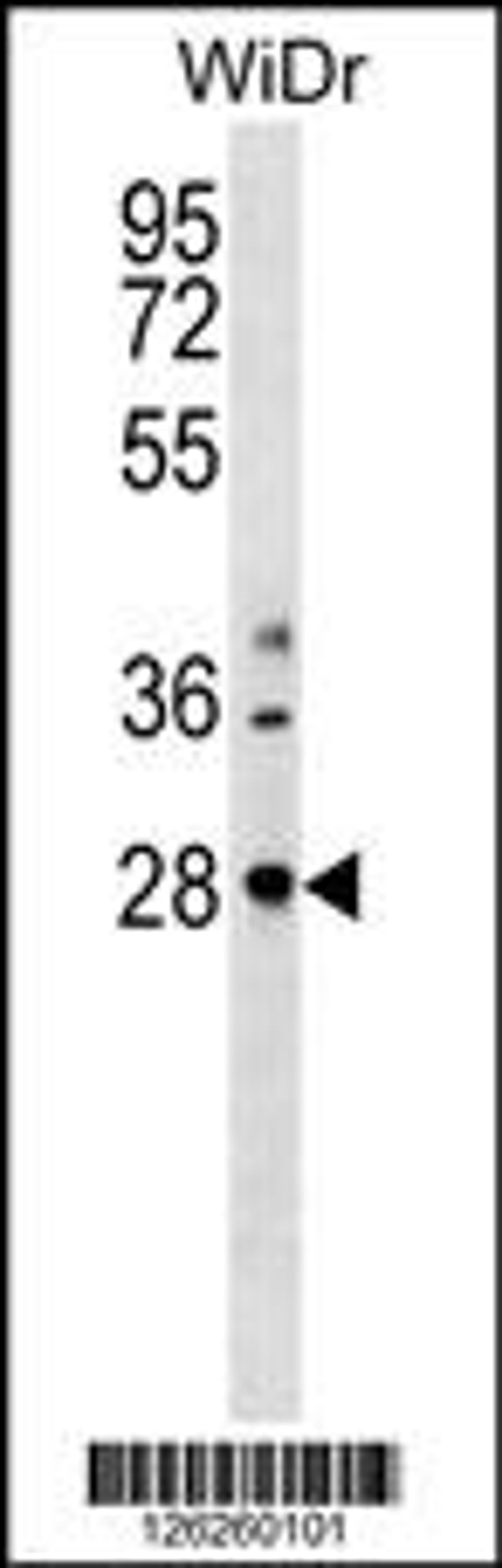 Western blot analysis in WiDr cell line lysates (35ug/lane).