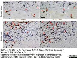 Mouse anti Human Nestin antibody used for the evaluation of nestin expression in aortic tissues