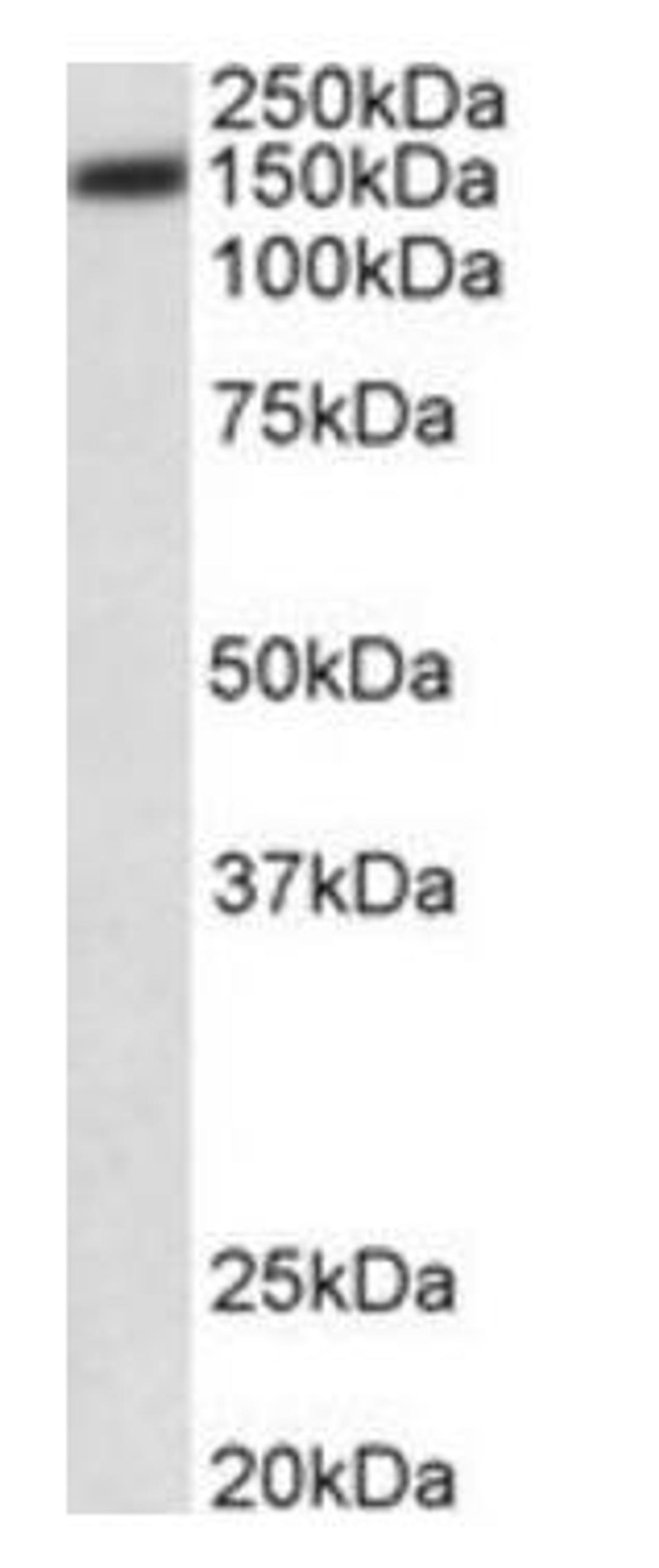 Western blot analysis of HeLa lysate using ATP2B1 antibody