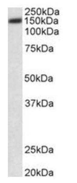 Western blot analysis of HeLa lysate using ATP2B1 antibody