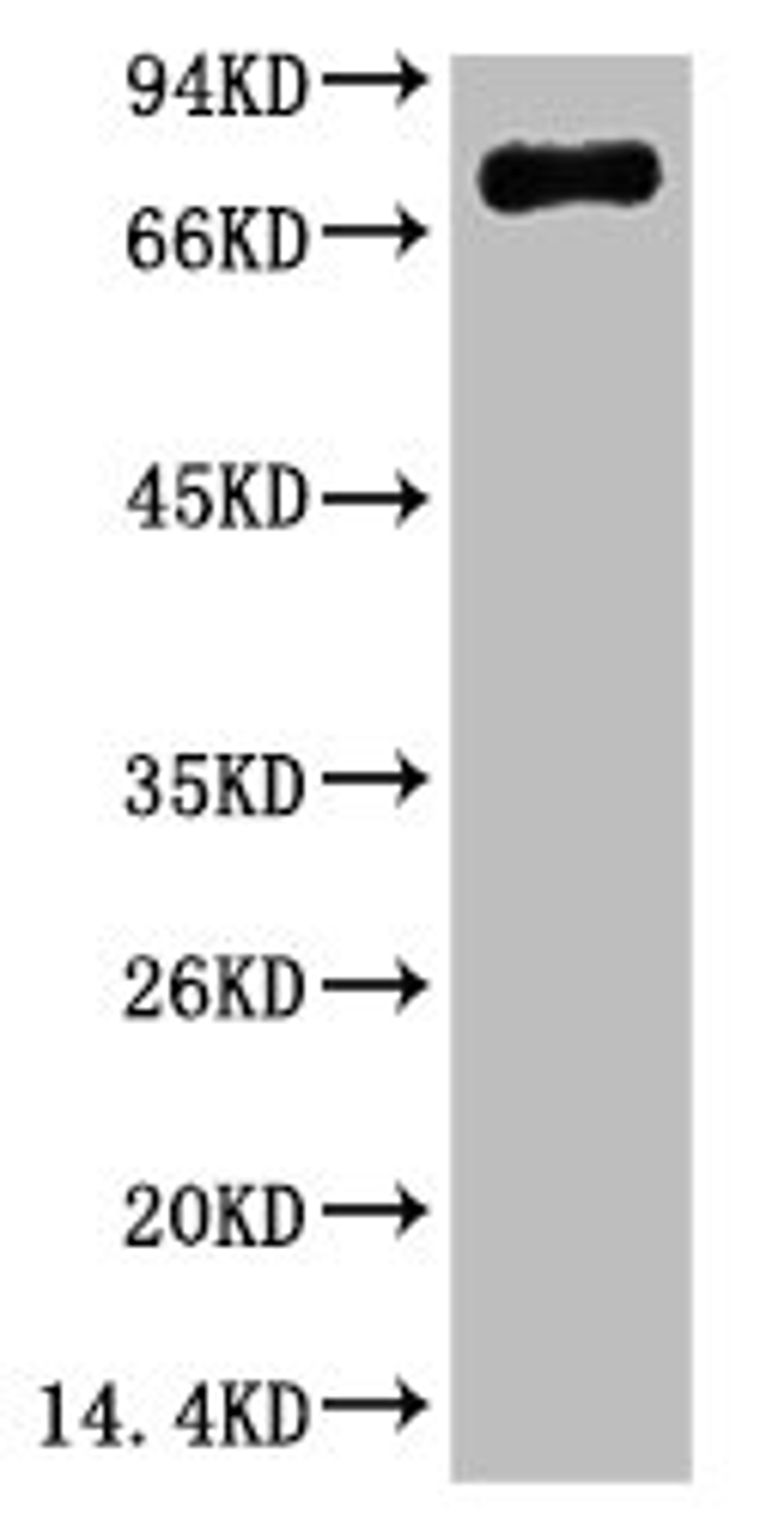 Western blot analysis of Human serum, mAb diluted at 1:2000.
