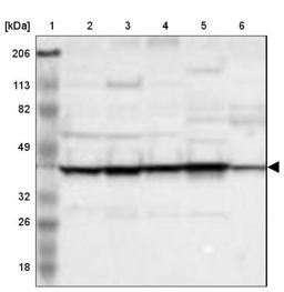 Western Blot: SPFH2 Antibody [NBP1-88247] - Lane 1: Marker [kDa] 206, 113, 82, 49, 32, 26, 18<br/>Lane 2: Human cell line RT-4<br/>Lane 3: Human cell line U-251MG sp<br/>Lane 4: Human cell line A-431<br/>Lane 5: Human liver tissue<br/>Lane 6: Human tonsil tissue