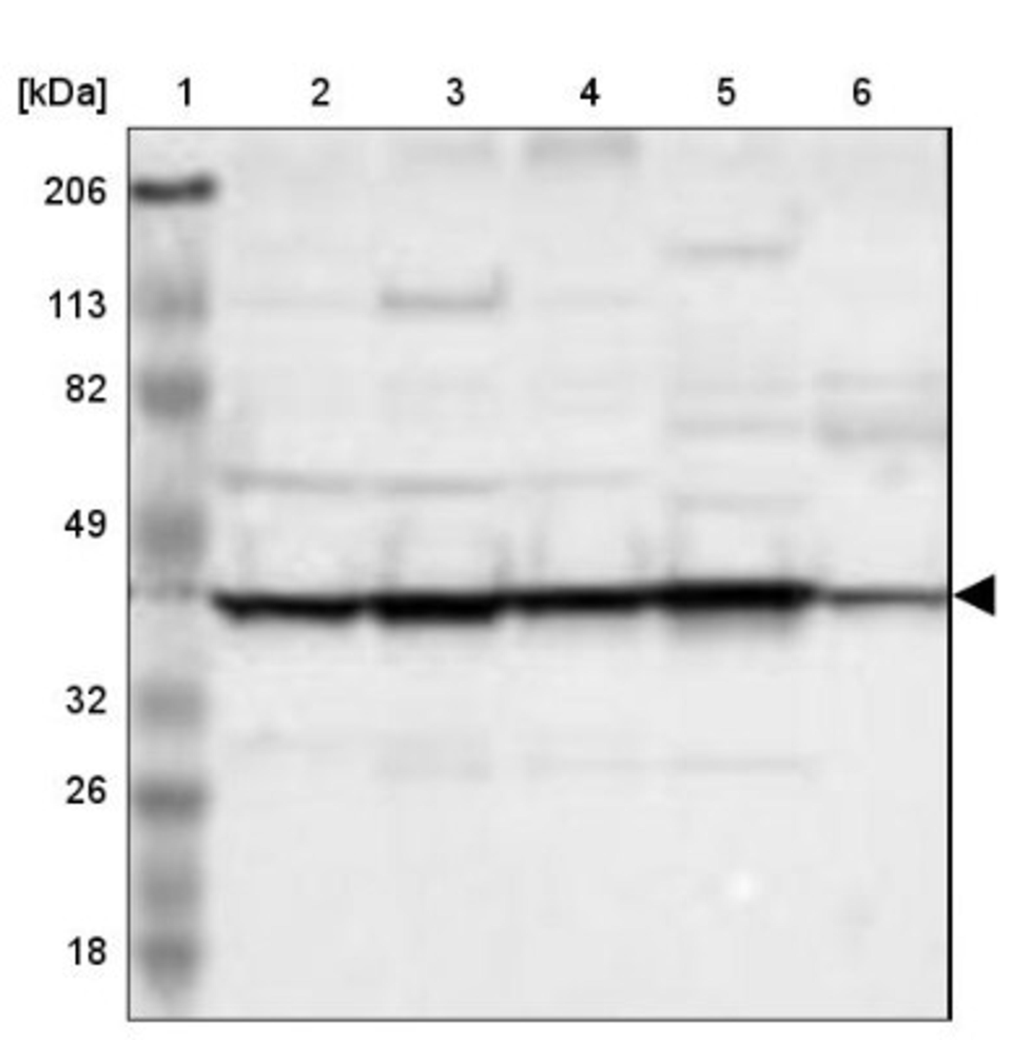 Western Blot: SPFH2 Antibody [NBP1-88247] - Lane 1: Marker [kDa] 206, 113, 82, 49, 32, 26, 18<br/>Lane 2: Human cell line RT-4<br/>Lane 3: Human cell line U-251MG sp<br/>Lane 4: Human cell line A-431<br/>Lane 5: Human liver tissue<br/>Lane 6: Human tonsil tissue