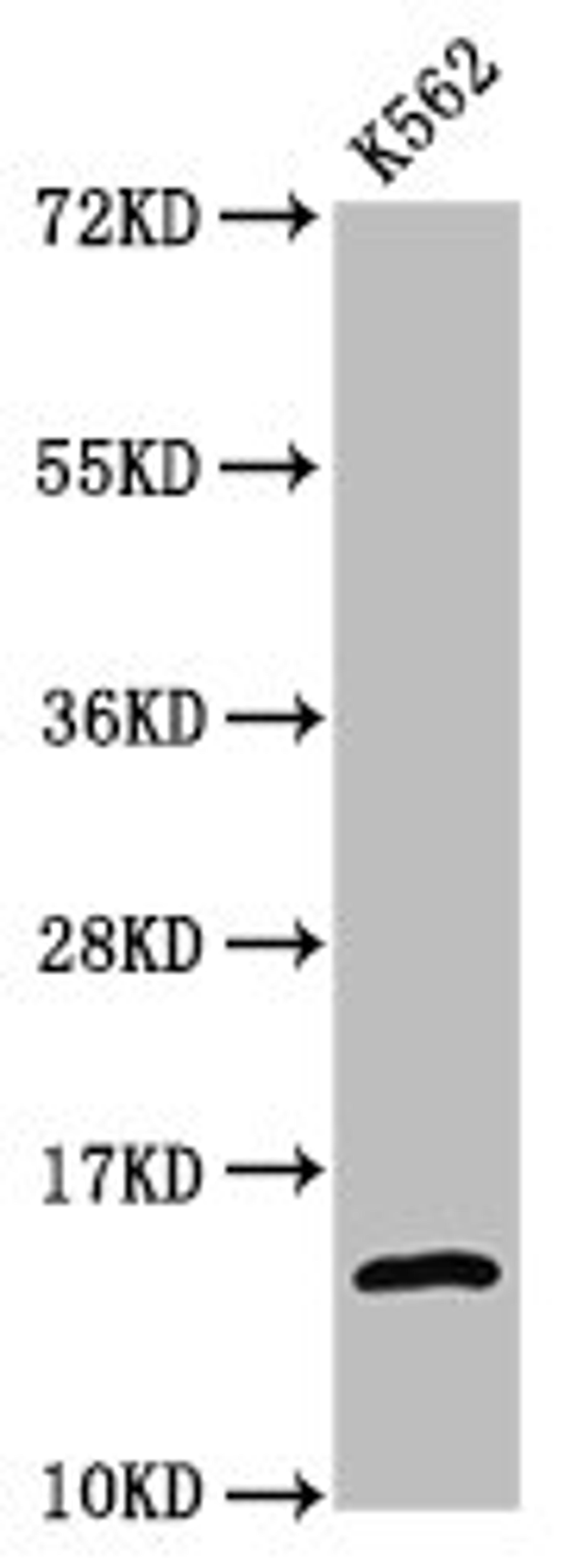 Western Blot. Positive WB detected in: K562 whole cell lysate (treated by 30mM sodium butyrate for 4h). All lanes: H2AFZ antibody at 1.06µg/ml. Secondary. Goat polyclonal to rabbit IgG at 1/50000 dilution. Predicted band size: 14 kDa. Observed band size: 14 kDa