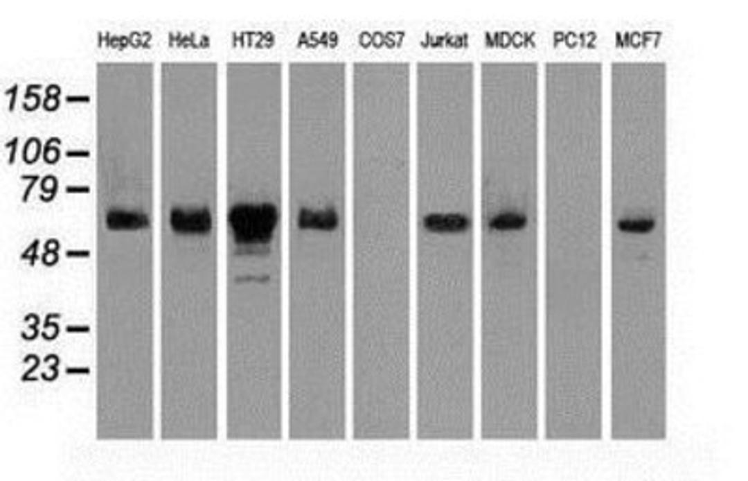 Western Blot: Chk2 Antibody (5C4) [NBP1-47695] Analysis of extracts (35ug) from 9 different cell lines by usin g anti-Chk2 monoclonal antibody (HepG2: human; HeLa: human; SVT2: mouse; A549: human; COS7: monkey; Jurkat: human; MDCK: canine; PC12: rat; MCF7: human).