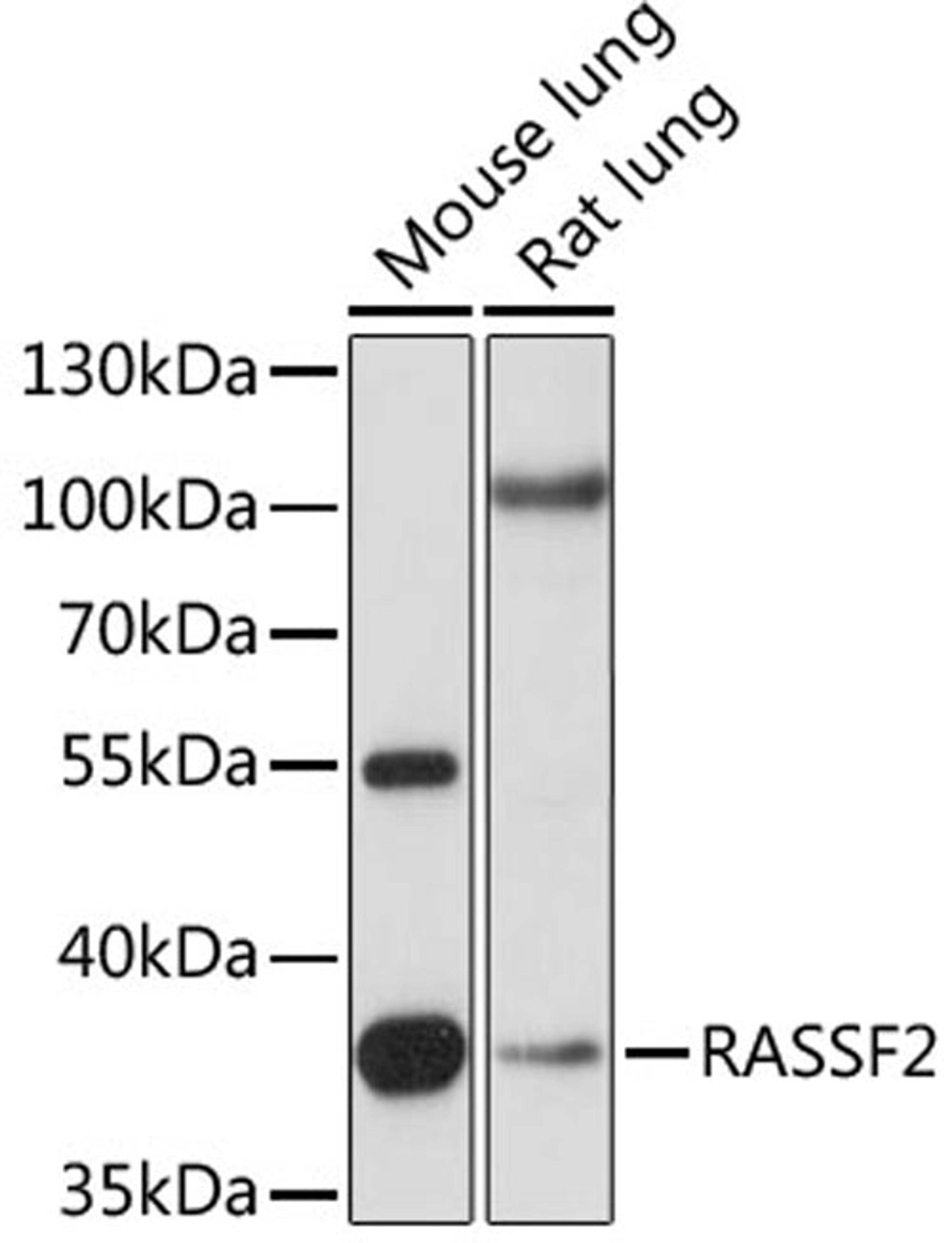 Western blot - RASSF2 antibody (A15767)