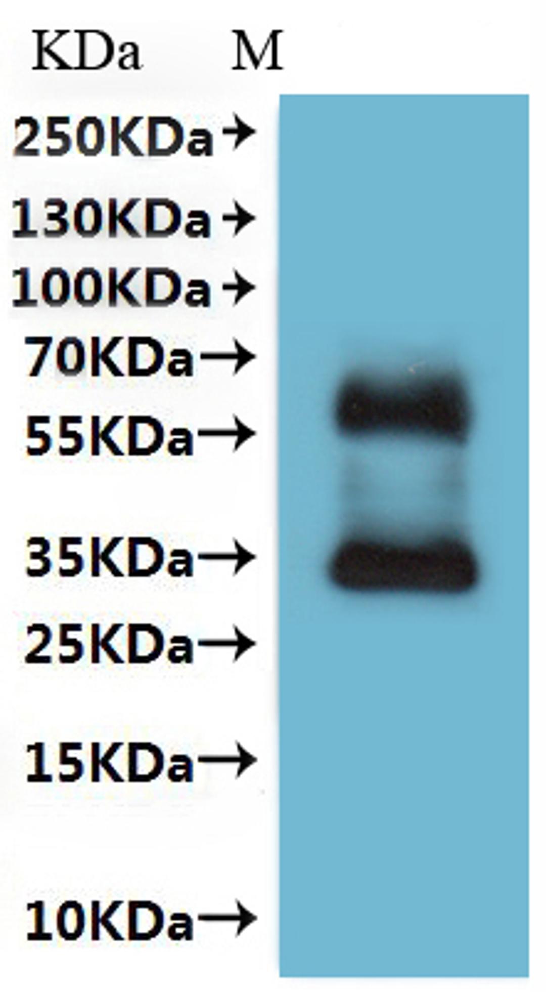 CSB-MP022727HU is detected by Mouse anti-6*His monoclonal antibody.