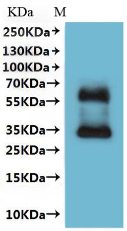 CSB-MP022727HU is detected by Mouse anti-6*His monoclonal antibody.