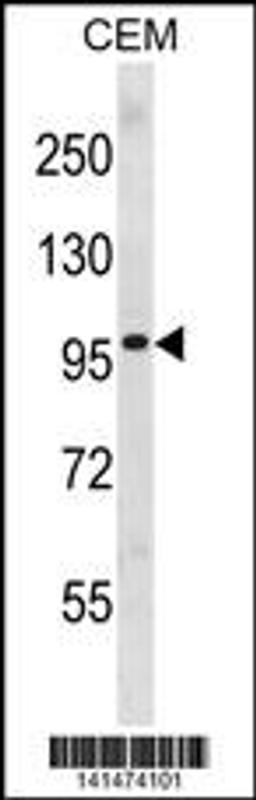 Western blot analysis in CEM cell line lysates (35ug/lane).