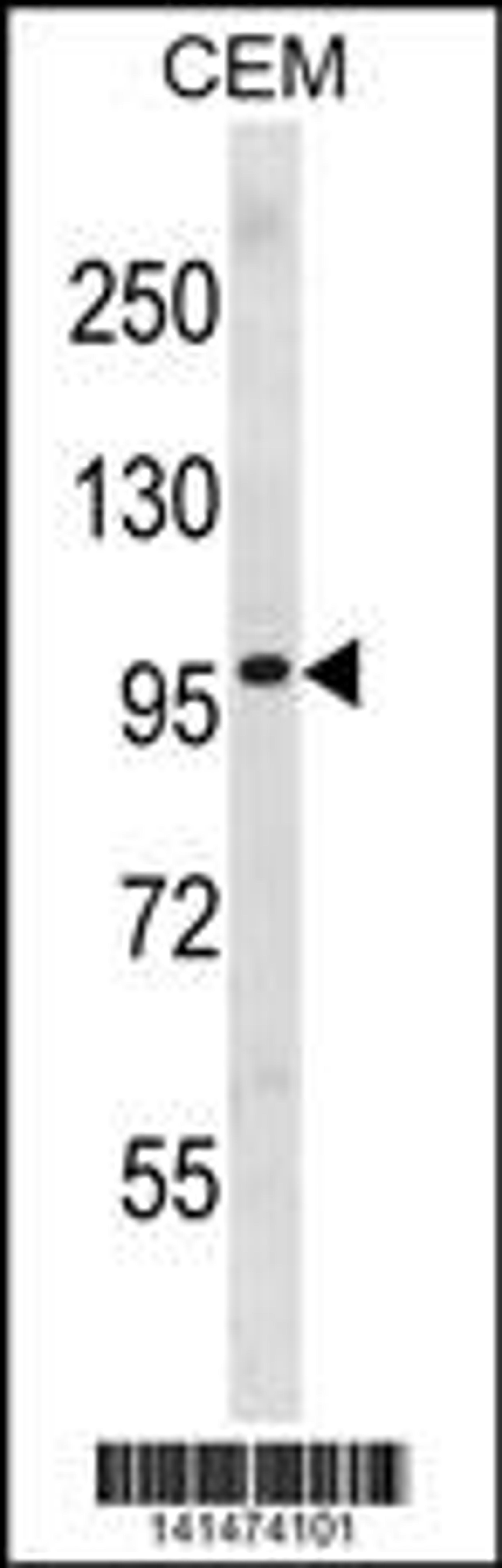 Western blot analysis in CEM cell line lysates (35ug/lane).