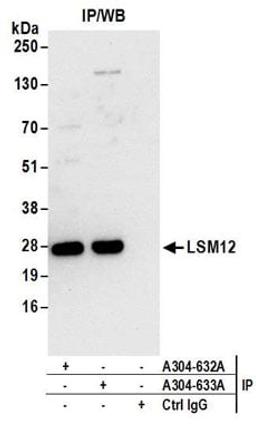 Detection of human LSM12 by western blot of immunoprecipitates.