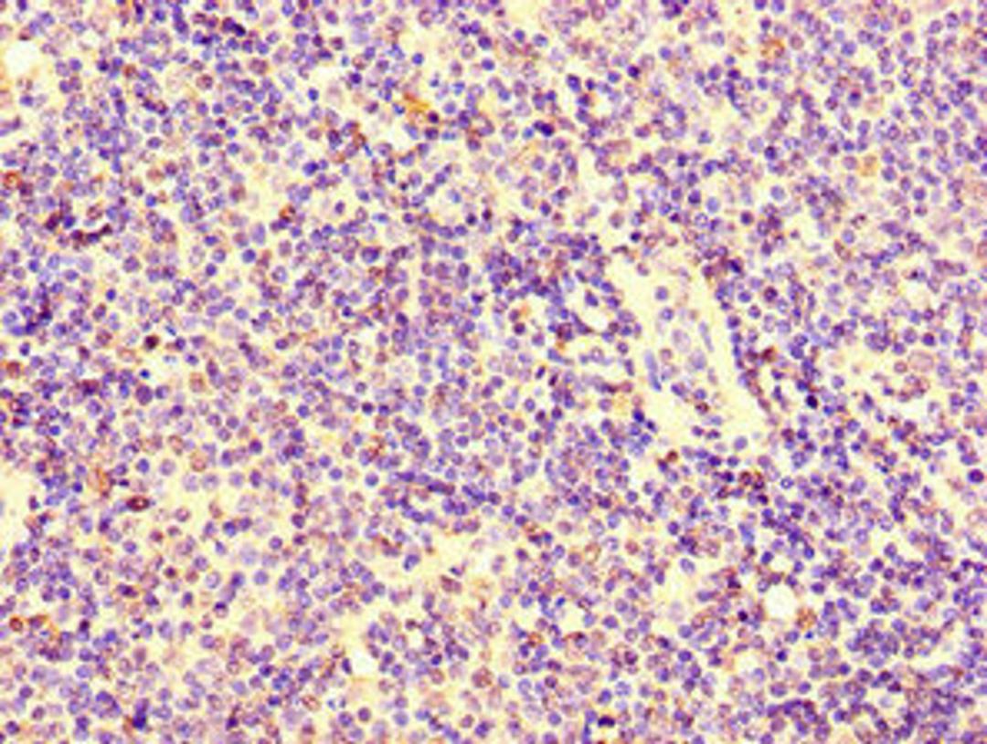Immunohistochemistry of paraffin-embedded human lymph node tissue using CSB-PA012484LA01HU at dilution of 1:100