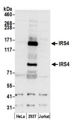 Detection of human IRS4 by western blot.