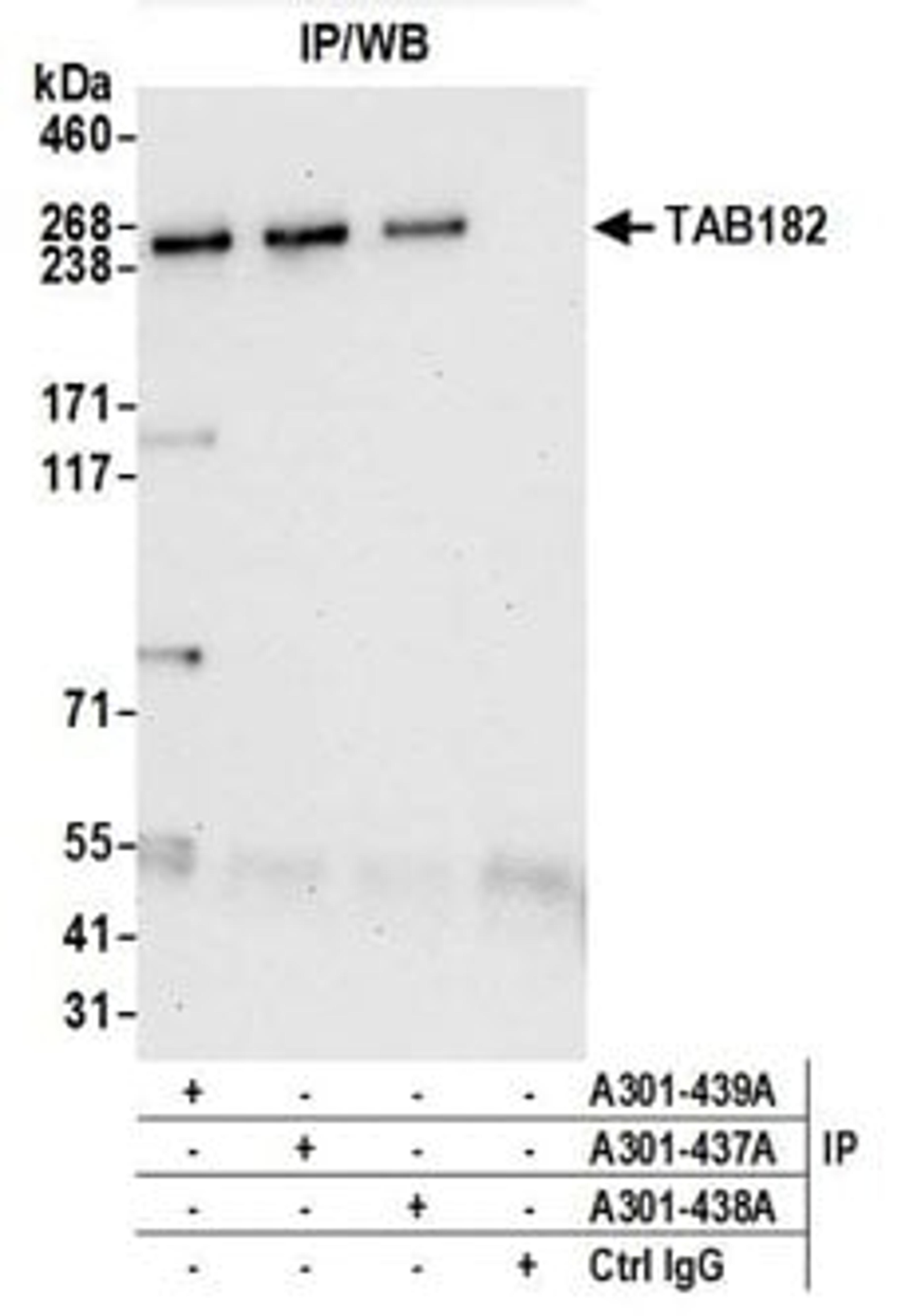 Detection of human TAB182 by western blot of immunoprecipitates.