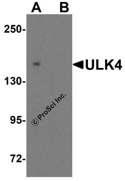 Western blot analysis of ULK4 in 3T3 cell lysate with ULK4 antibody at 0.5 μg/ml in (A) the absence and (B) the presence of blocking peptide.