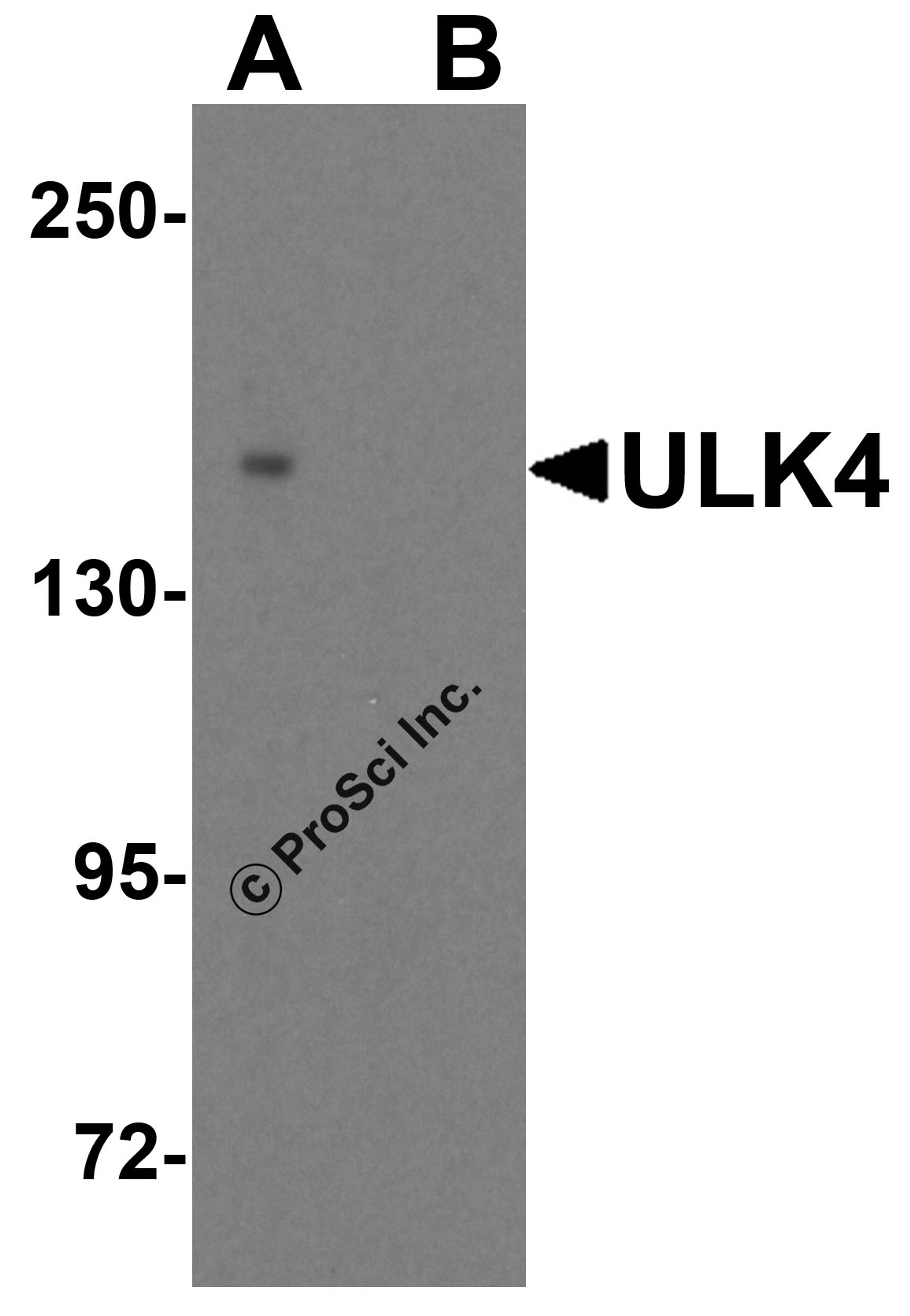 Western blot analysis of ULK4 in 3T3 cell lysate with ULK4 antibody at 0.5 μg/ml in (A) the absence and (B) the presence of blocking peptide.