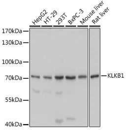 Western blot - KLKB1 antibody (A5318)