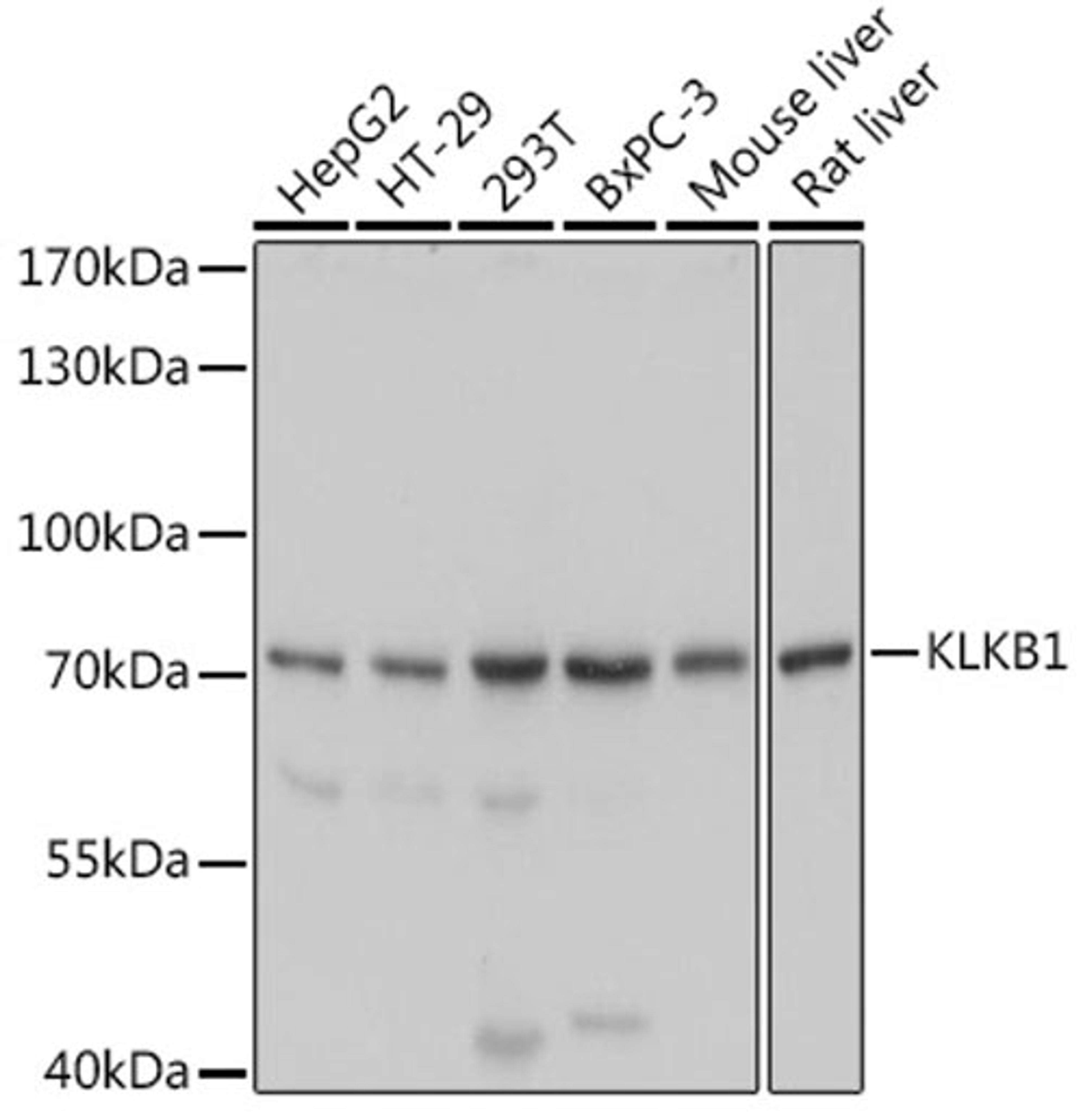 Western blot - KLKB1 antibody (A5318)