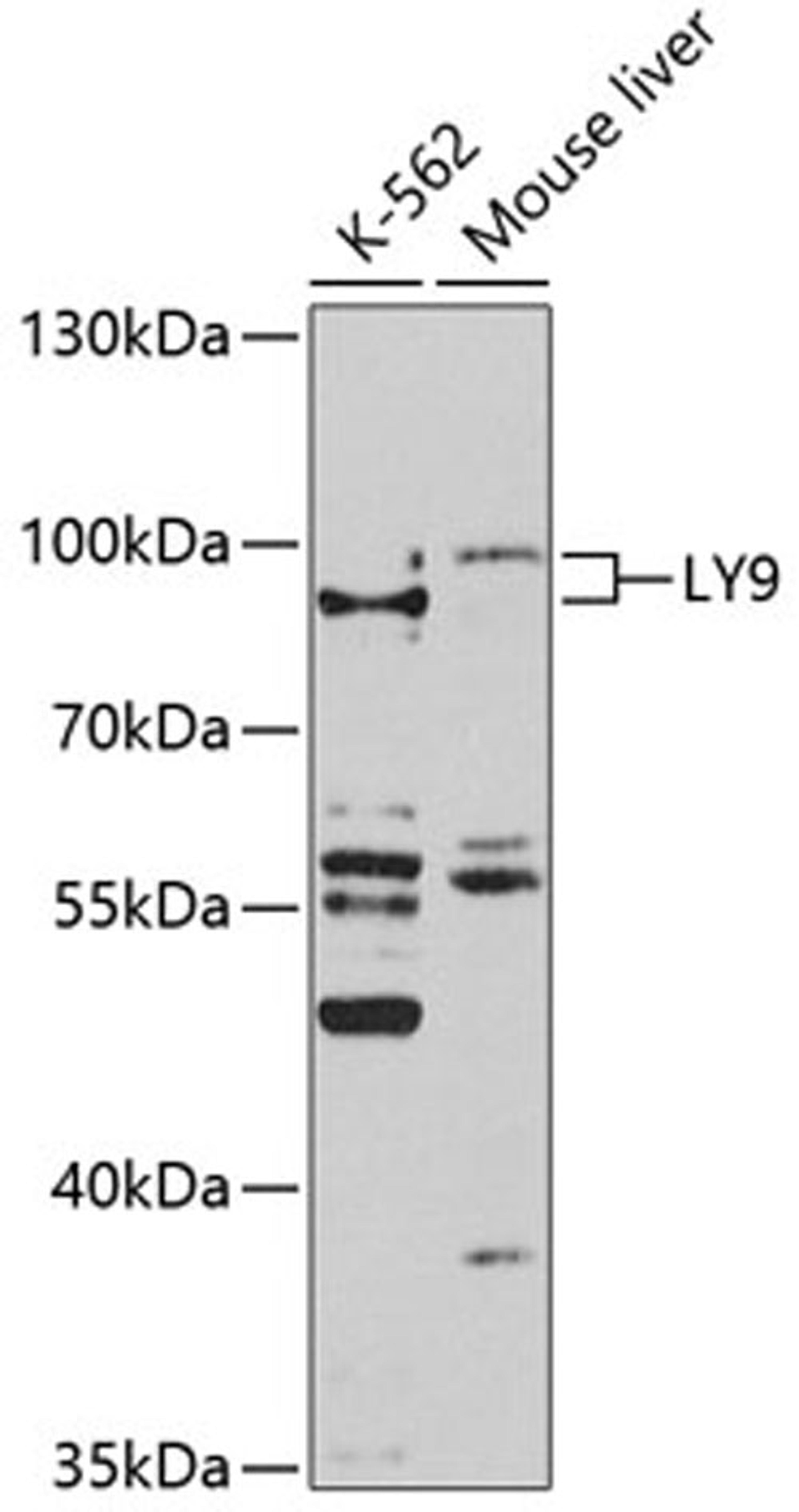 Western blot - LY9 antibody (A10032)