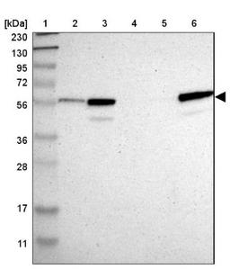 Western Blot: CRLF3 Antibody [NBP1-84382] - Lane 1: Marker [kDa] 230, 130, 95, 72, 56, 36, 28, 17, 11<br/>Lane 2: Human cell line RT-4<br/>Lane 3: Human cell line U-251MG sp<br/>Lane 4: Human plasma (IgG/HSA depleted)<br/>Lane 5: Human liver tissue<br/>Lane 6: Human tonsil tissue