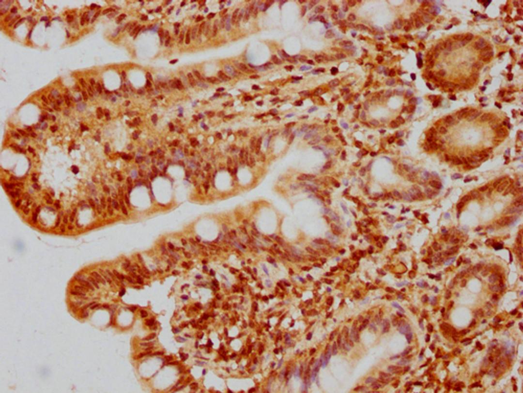 IHC image of CSB-PA010429PA44nhibHU diluted at 1:10 and staining in paraffin-embedded human small intestine tissue performed on a Leica BondTM system. After dewaxing and hydration, antigen retrieval was mediated by high pressure in a citrate buffer (pH 6.0). Section was blocked with 10% normal goat serum 30min at RT. Then primary antibody (1% BSA) was incubated at 4°C overnight. The primary is detected by a biotinylated secondary antibody and visualized using an HRP conjugated SP system.