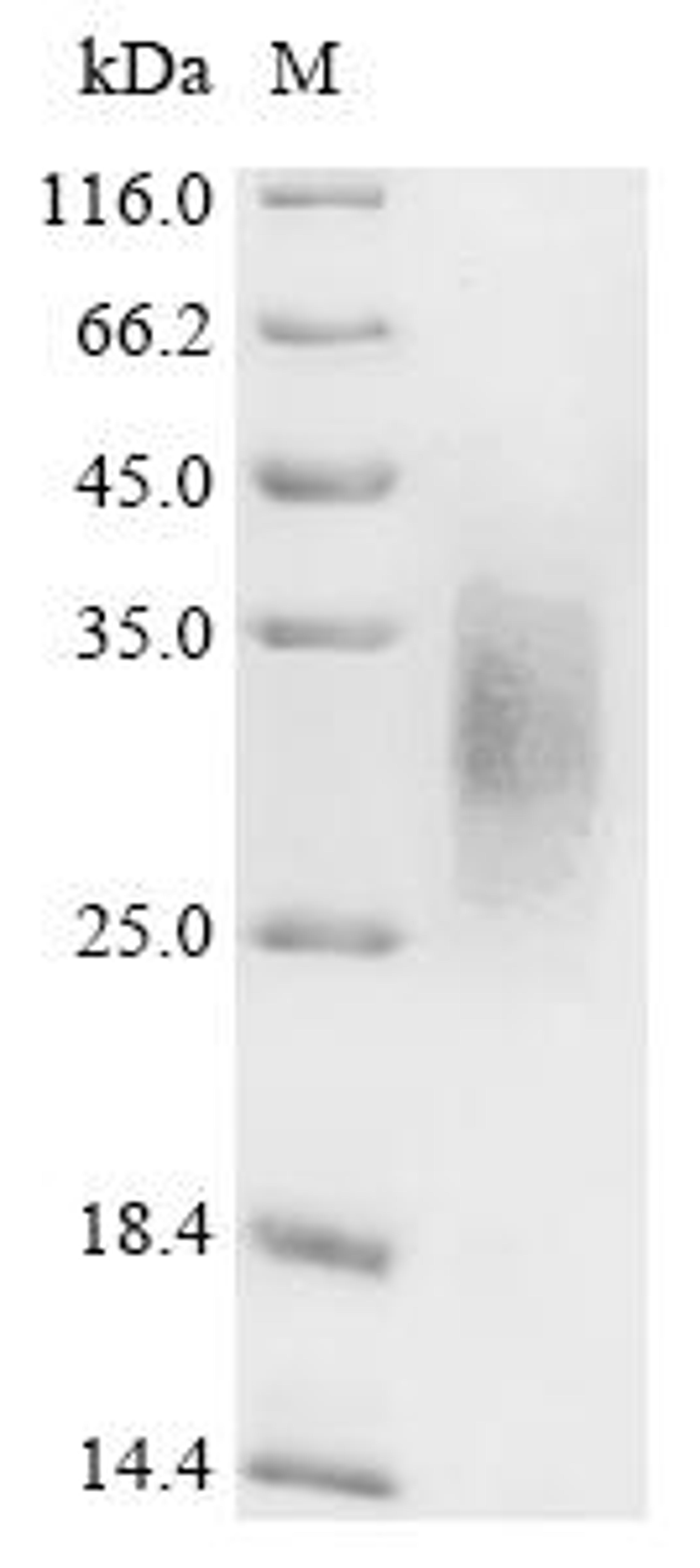 (Tris-Glycine gel) Discontinuous SDS-PAGE (reduced) with 5% enrichment gel and 15% separation gel.
