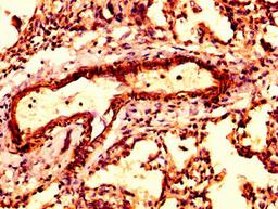 IHC image of CSB-PA002130LA01HU diluted at 1:300 and staining in paraffin-embedded human lung tissue performed on a Leica BondTM system. After dewaxing and hydration, antigen retrieval was mediated by high pressure in a citrate buffer (pH 6.0). Section was blocked with 10% normal goat serum 30min at RT. Then primary antibody (1% BSA) was incubated at 4&deg;C overnight. The primary is detected by a biotinylated secondary antibody and visualized using an HRP conjugated SP system.