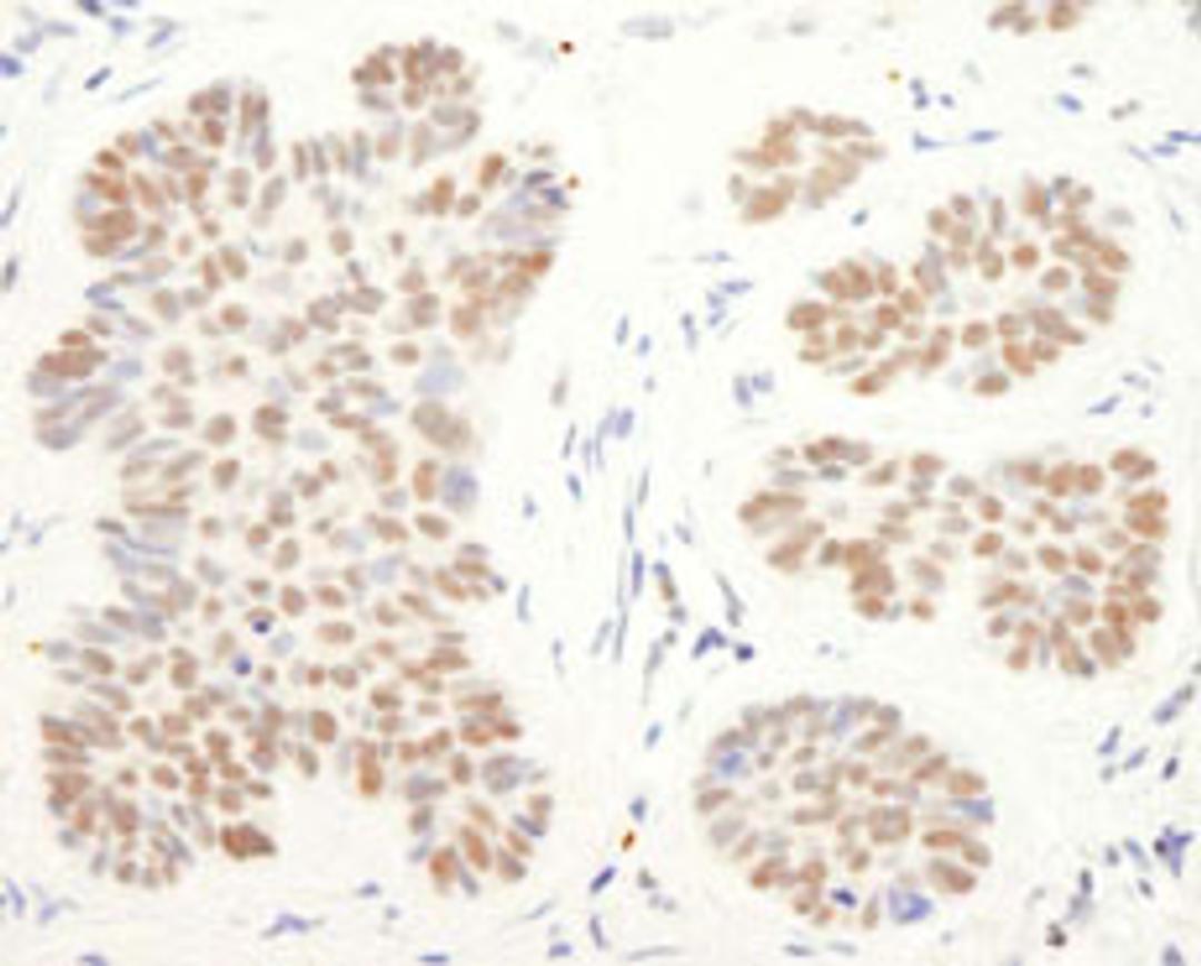 Detection of human CoREST by immunohistochemistry.