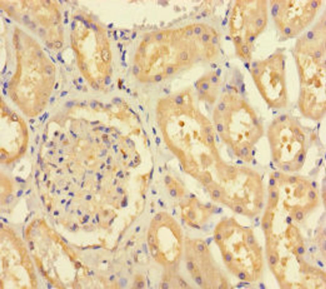 Immunohistochemistry of paraffin-embedded human kidney tissue using CSB-PA850424LA01HU at dilution of 1:100