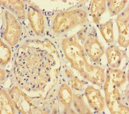 Immunohistochemistry of paraffin-embedded human kidney tissue using CSB-PA850424LA01HU at dilution of 1:100