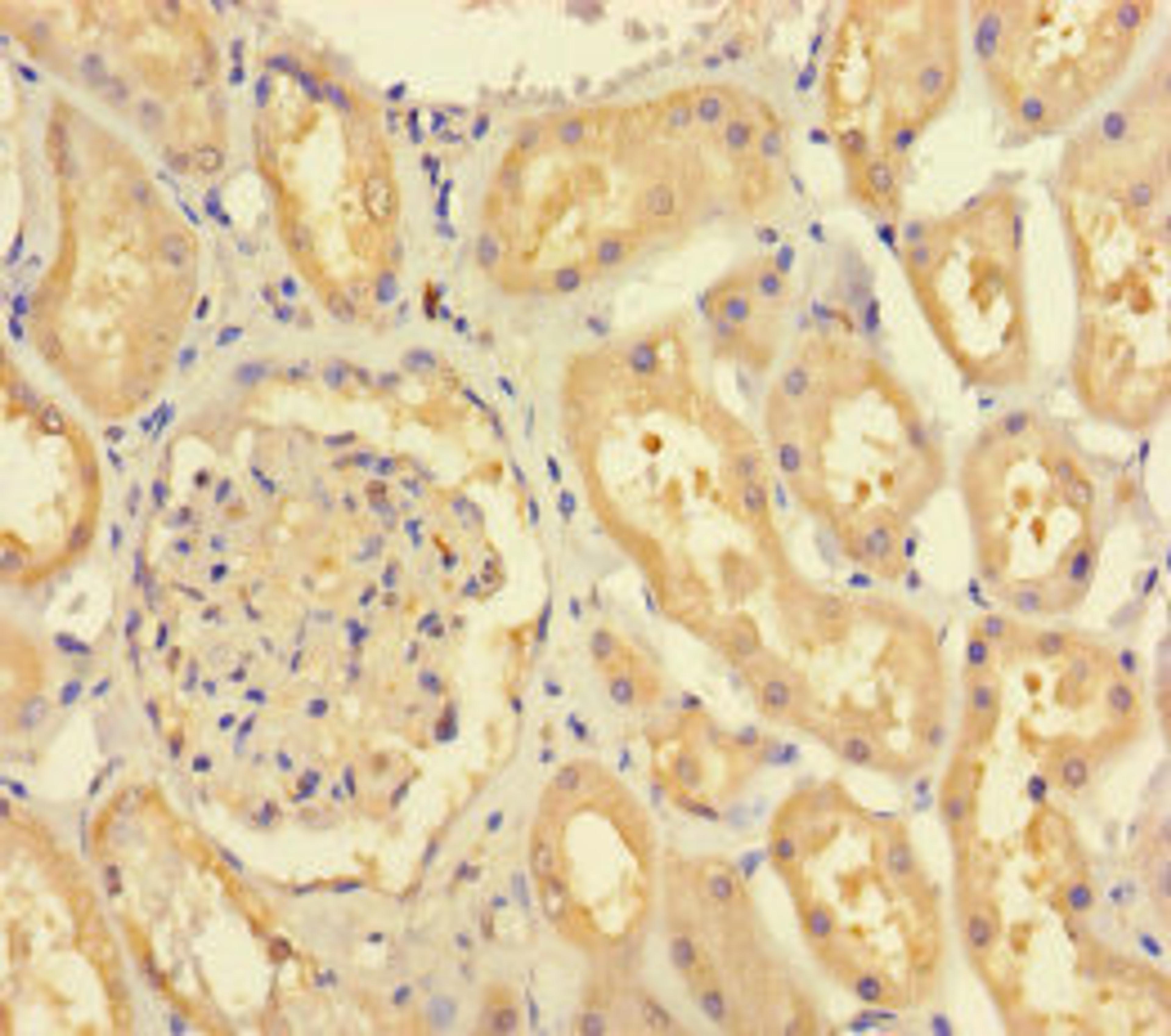 Immunohistochemistry of paraffin-embedded human kidney tissue using CSB-PA850424LA01HU at dilution of 1:100