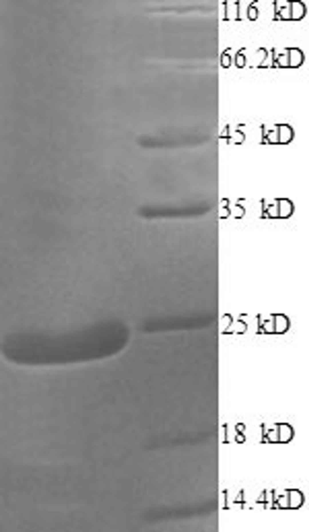 (Tris-Glycine gel) Discontinuous SDS-PAGE (reduced) with 5% enrichment gel and 15% separation gel.