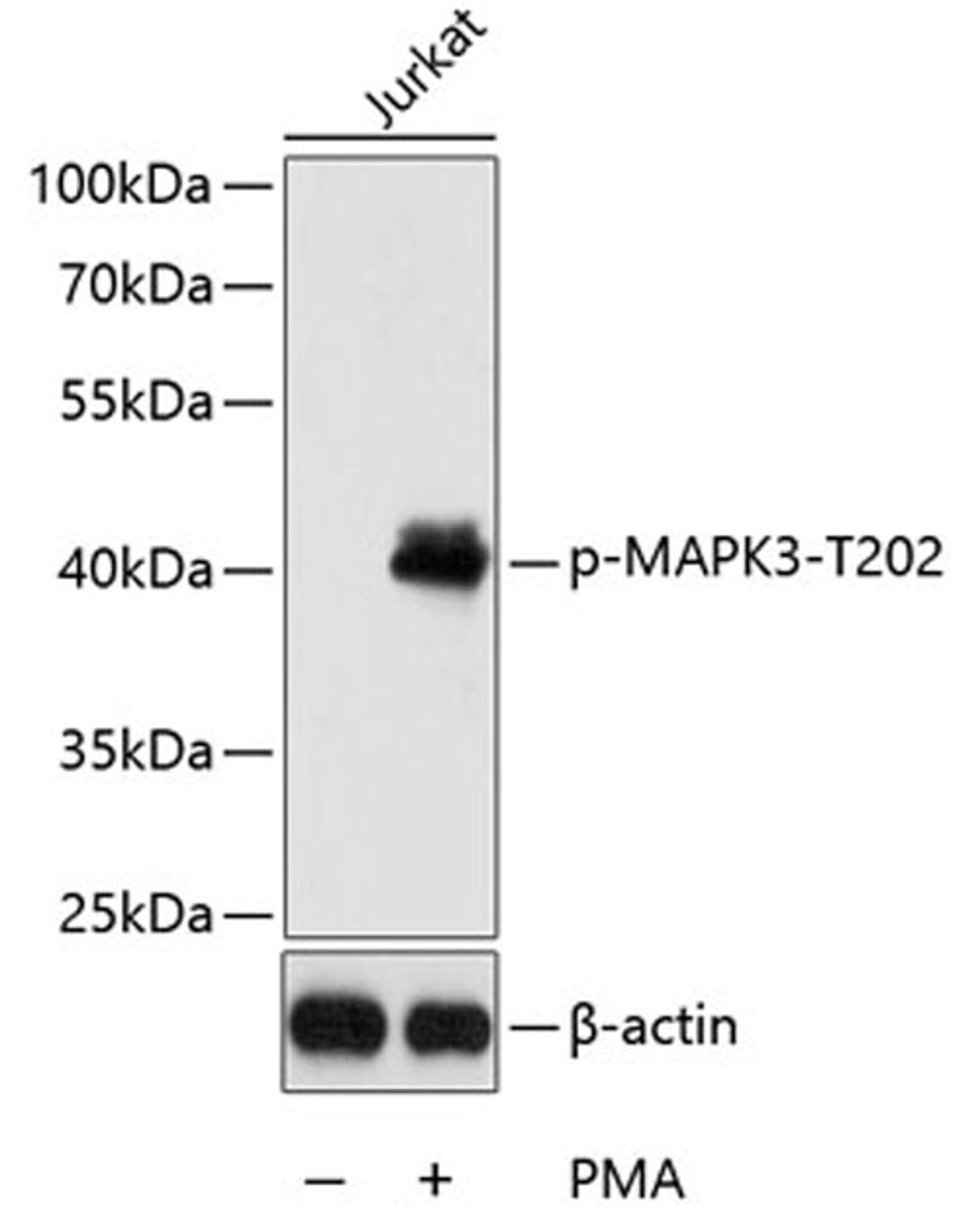 Western blot - Phospho-MAPK3-T202 antibody (AP0234)