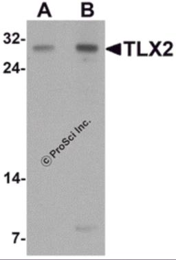 Western blot analysis of TLX2 in rat brain tissue lysate with TLX2 antibody at (A) 0.5 and (B) 1 &#956;g/mL.