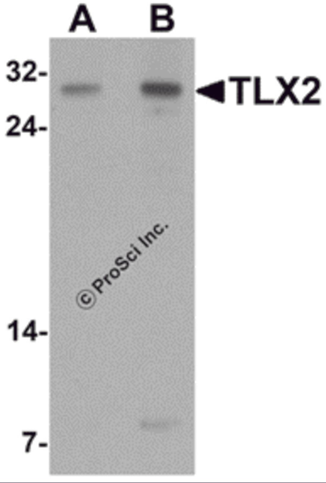 Western blot analysis of TLX2 in rat brain tissue lysate with TLX2 antibody at (A) 0.5 and (B) 1 μg/mL.