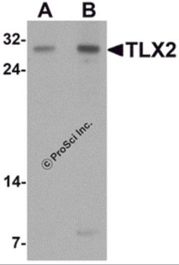 Western blot analysis of TLX2 in rat brain tissue lysate with TLX2 antibody at (A) 0.5 and (B) 1 μg/mL.