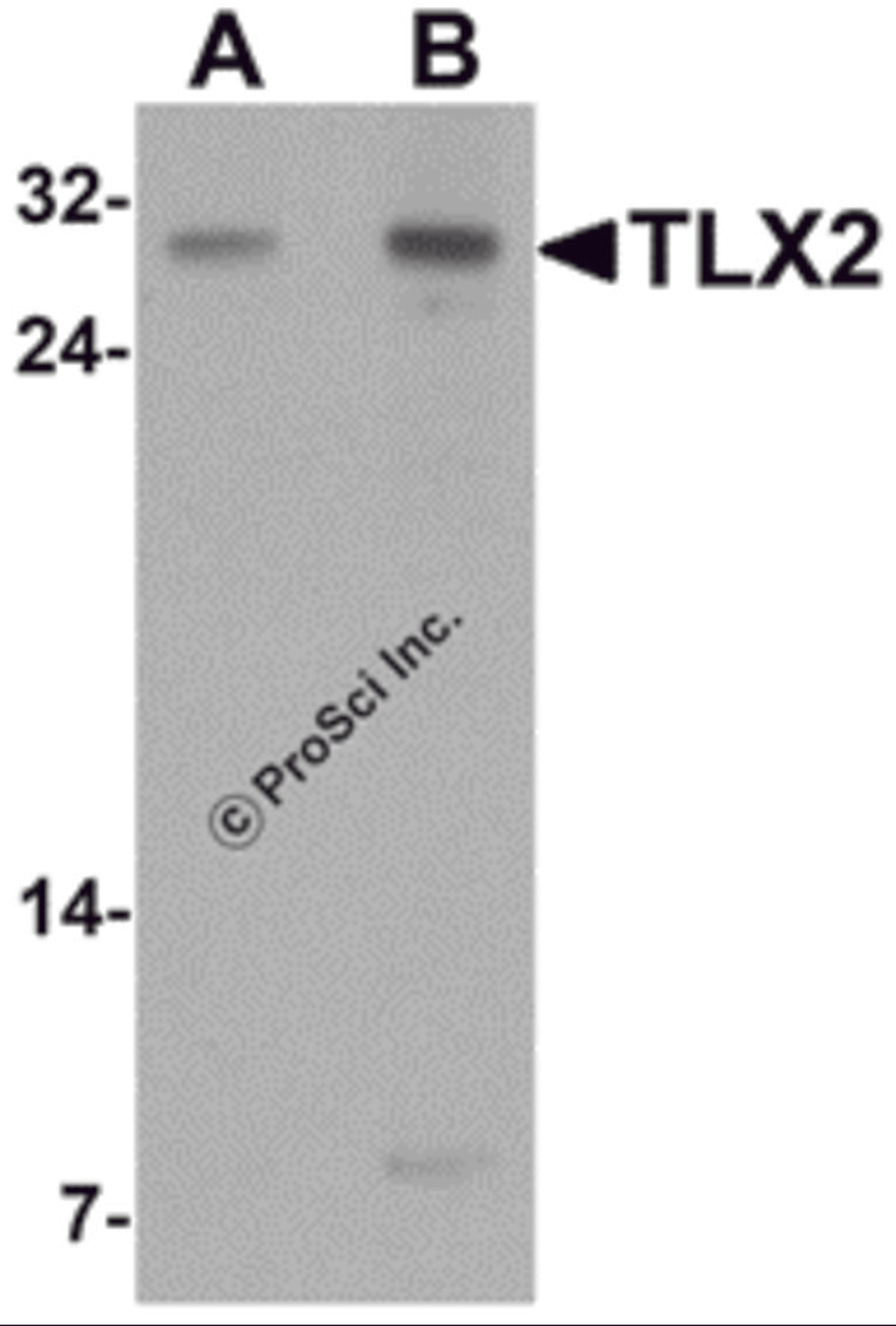 Western blot analysis of TLX2 in rat brain tissue lysate with TLX2 antibody at (A) 0.5 and (B) 1 μg/mL.